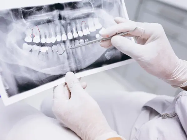 Dentista revisando una radiografía panorámica dental