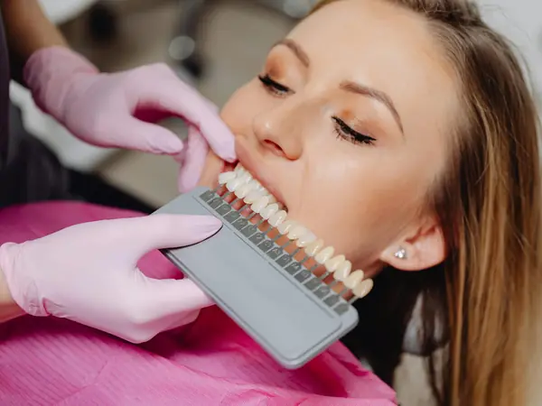 Dentista comparando el color de los dientes de una paciente con una guía de colores